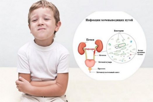 Цистит у детей