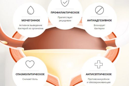 Признаки цистита