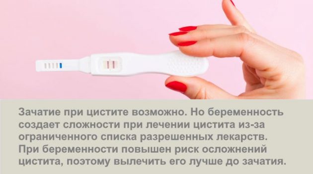 Можно ли забеременеть при цистите