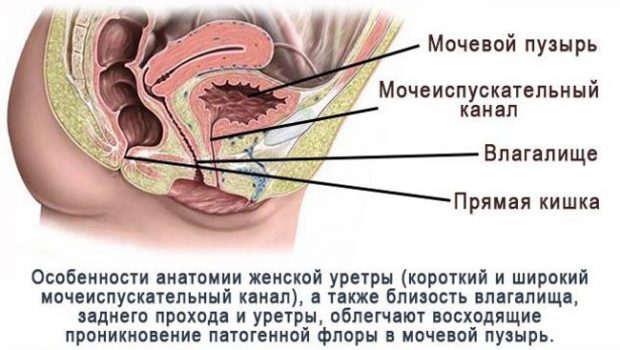 Цистит после секса