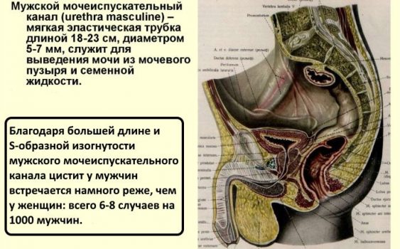 Мужской цистит