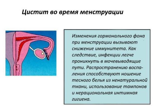 Цистит и месячные