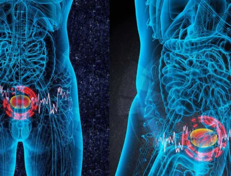 Интерстициальный цистит: симптомы и лечение