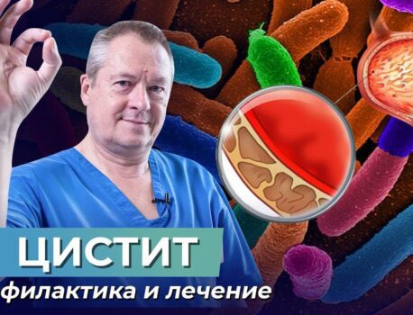 Лечение цистита у женщин