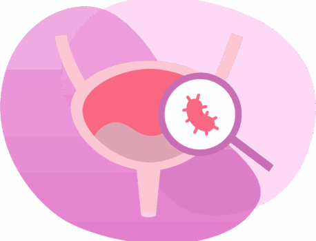 Цистит медового месяца